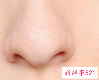 皮肤不好毛孔粗大怎么改善