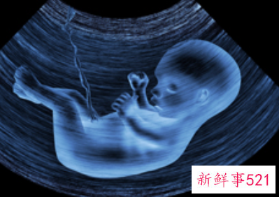 老是假宫缩就是不发动