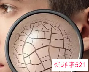 皮肤干缺水是什么原因造成的