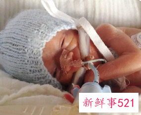 早产儿护理常规