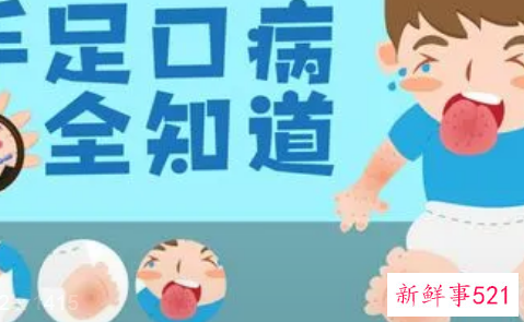 四月如何预防手足口病