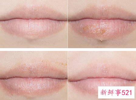 去唇毛的小妙招有哪些