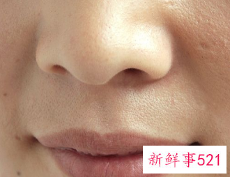 皮肤黑用什么能变白