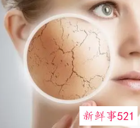 面部干燥脱皮要怎么调理