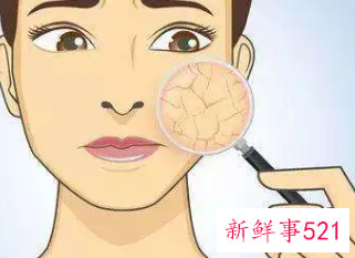 皮肤干缺水是什么原因造成的