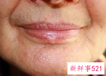 男人面部过早衰老怎么改善