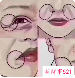 静态纹和动态纹哪个更严重