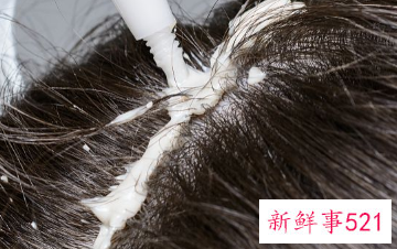 白醋去头屑最快最有效