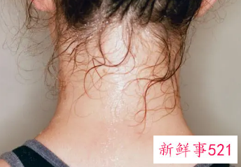 身体总有汗味怎么回事