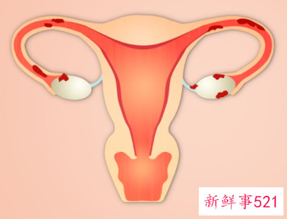 什么运动可以改善卵巢功能