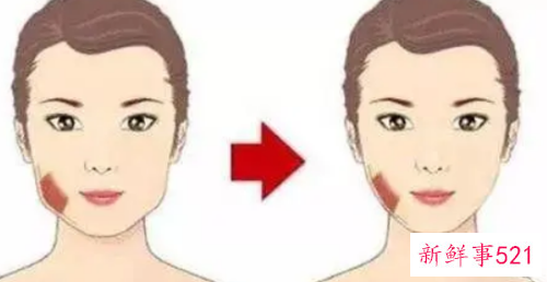 脸太宽了只能磨骨吗