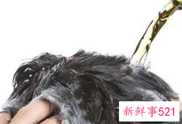 白醋去头屑最快最有效