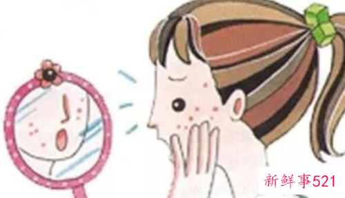 经期前后痘痘该如何护理深层痘疤要如何去除