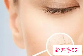 面部干燥脱皮要怎么调理