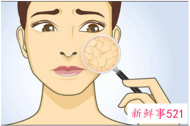春季脱水肌肤补水妙招