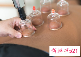 拔罐后的注意事项