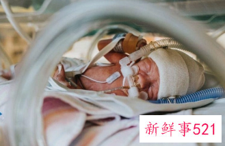 早产儿护理常规