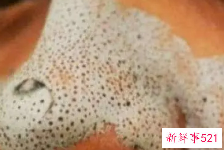 怎样快速去黑头呢