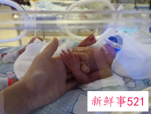 早产儿护理常规