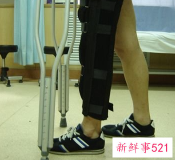 韧带拉伤怎么办恢复快