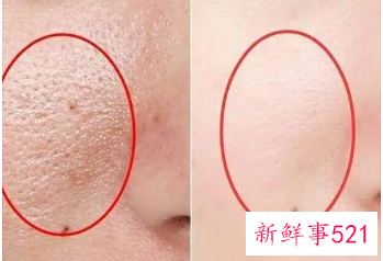 皮肤有哪些层次