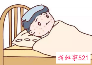 幼儿急疹出疹子后禁忌