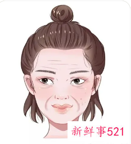 静态纹和动态纹哪个更严重