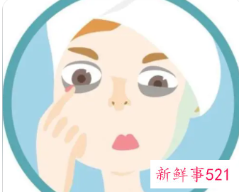 7个省钱小绝招帮你消除可恶黑眼圈