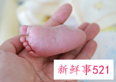 剖腹产结扎好吗