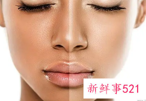 皮肤黑用什么能变白