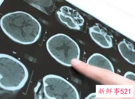 ct照多了对身体有害吗