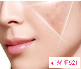 皮肤黑用什么能变白