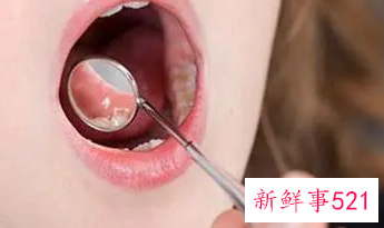 婴儿如何洗舌头