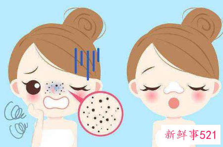 鼻子上的黑头是如何形成的