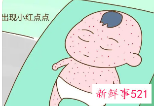 幼儿急疹出疹子后禁忌