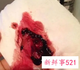 月经量少颜色褐红色是什么原因