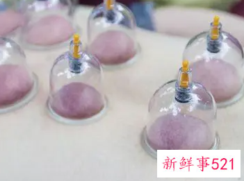拔罐后的注意事项