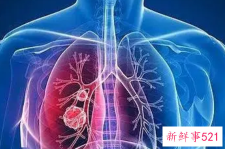 氡对人体的危害