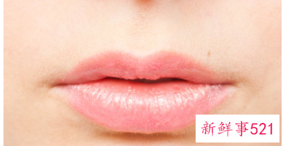 嘴角两侧皮肤干燥起皮