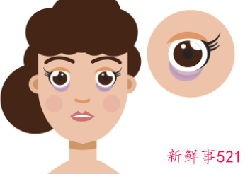 小孩眼袋重是什么原因造成的