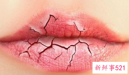 嘴唇干裂脱皮小妙招