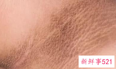 身体健康小知识