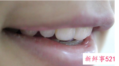 每天坚持刷牙为什么还是很黄