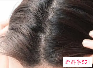 怎样让头发比较顺