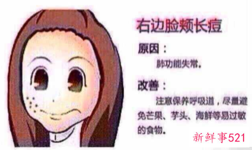 长痘的原因是什么