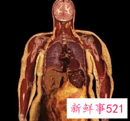 内脏脂肪的克星