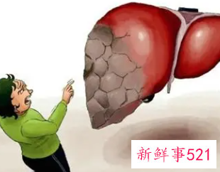 肝病早期九大征兆