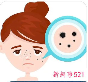 祛斑激光好还是药水