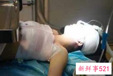 隆胸手术前注意事项有哪些