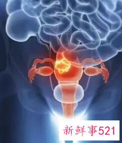 女人的卵巢在哪里